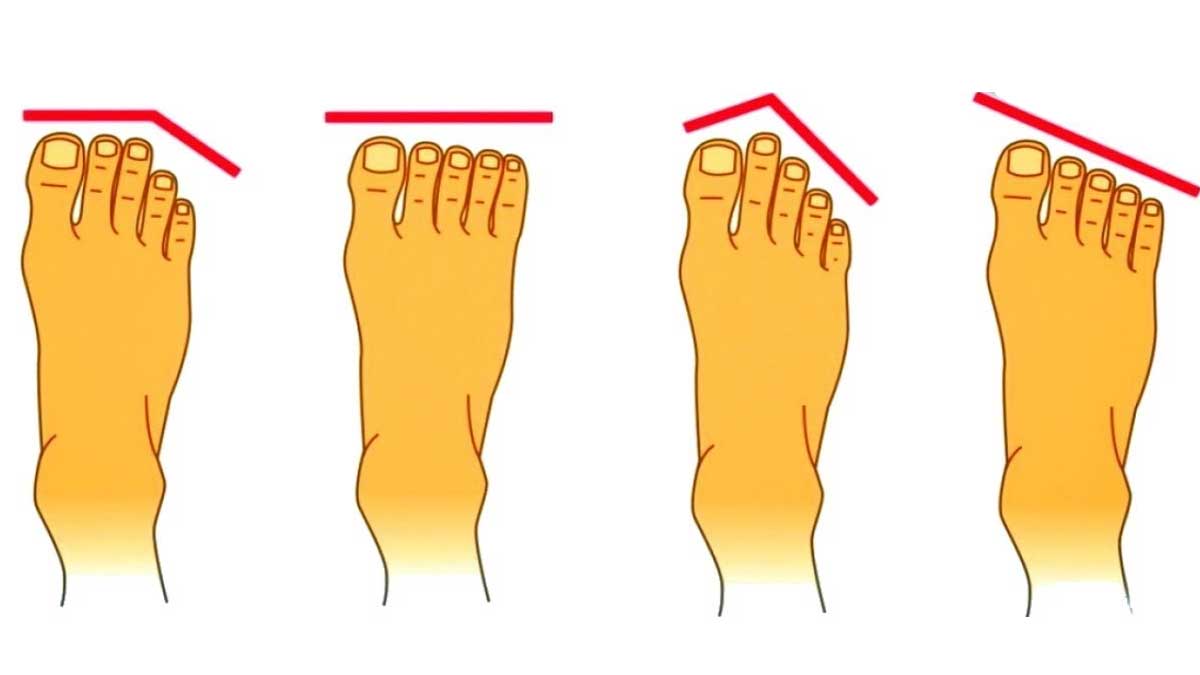 if you have these types of feet then you are lucky 