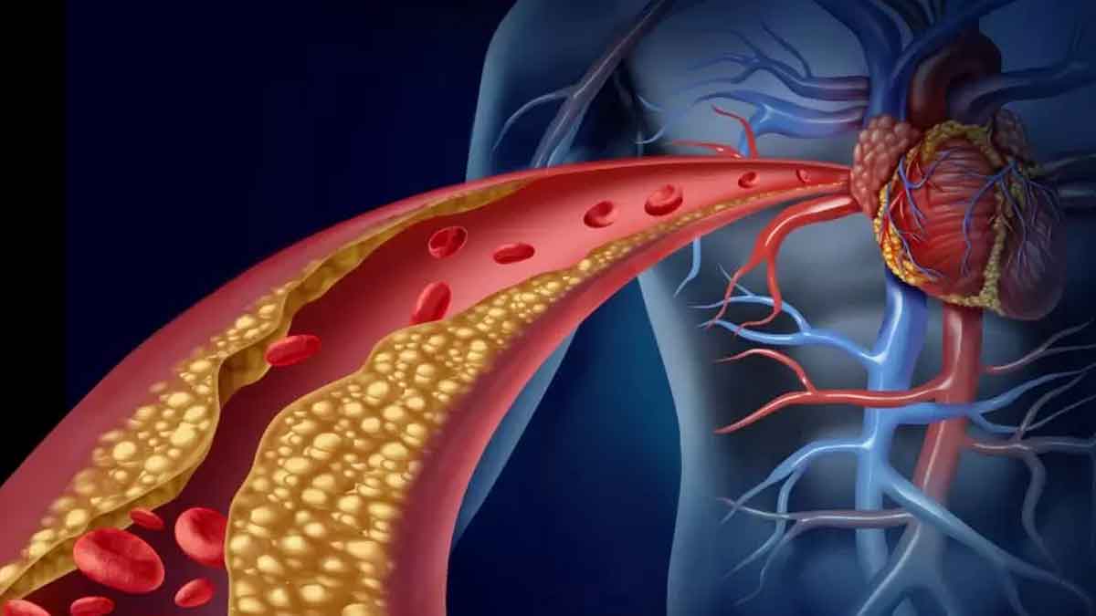 take these 5 fruits daily to reduce cholesterol 