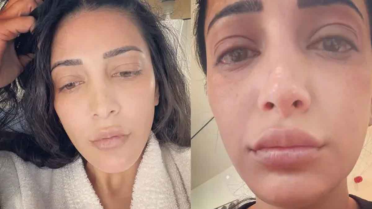 Shruti Haasan : శృతి హాసన్కు ఏమైంది.. ఇలా మారిపోయింది.. వైరల్ అవుతున్న ఫొటో.. Shruti Haasan latest photo viral netizen surprised