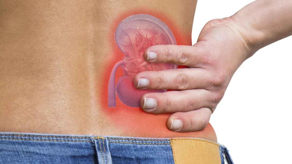 Kidney Stones : వీటిని తీసుకుంటే ఎంతటి కిడ్నీ స్టోన్లు అయినా సరే కరిగిపోతాయి..! Kidney Stones natural remedies follow these
