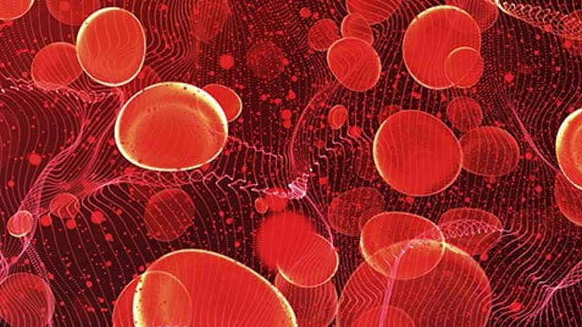 Anemia : ఈ లక్షణాలు కనిపిస్తున్నాయా.. అయితే మీ శరీరంలో రక్తం లేనట్లే..! Anemia symptoms know what to do