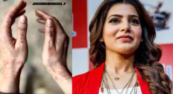 Samantha : స‌మంత చేతుల‌కి గాయాలు.. ర‌క్తం కారుతున్న చేతులు చూసి షాక్‌లో ఫ్యాన్స్..