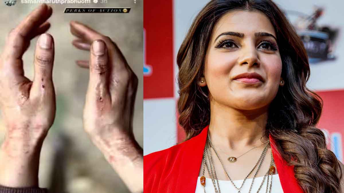 Samantha got injured while movie making photo viral 