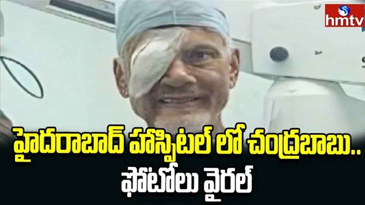 Chandra Babu got his eye surgery 